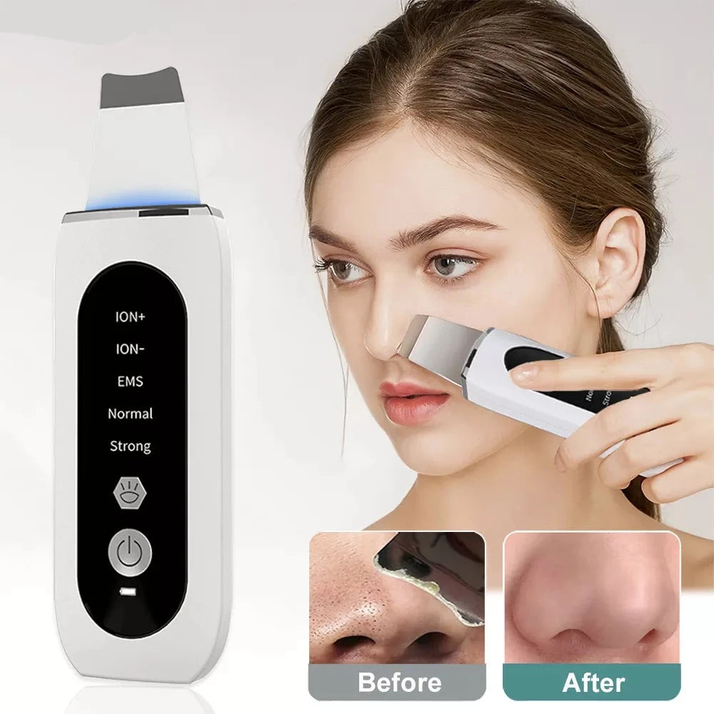 Ultrasonic Skin Scrubber Peeling Blackhead RemoverSpecifications:
Material: AcrylicPower Source: Rechargeable BatteryWorking Principle: WarmWorking Principle: UltrasonicWorking Principle: Vibration MassageFunction: Beauty Accessories NowBeauty Accessories NowUltrasonic Skin Scrubber Peeling Blackhead Remover