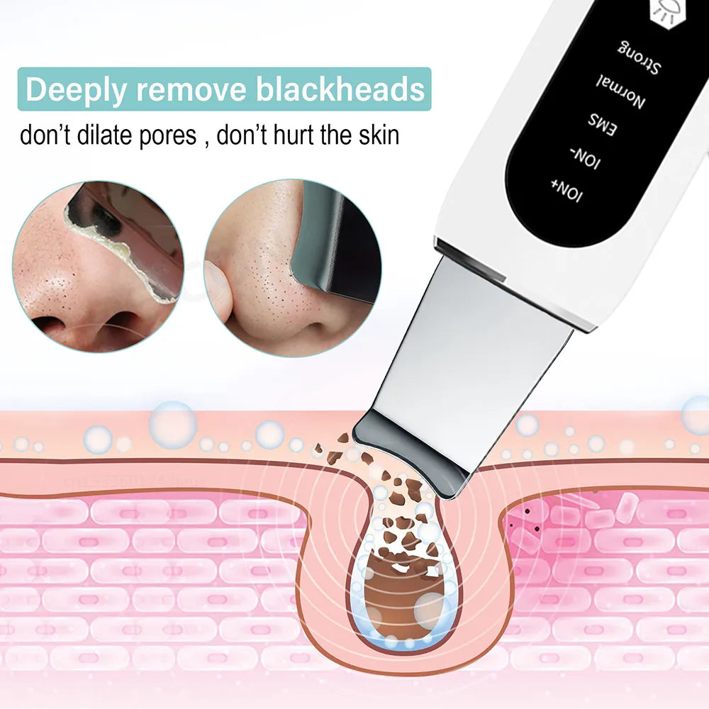 Ultrasonic Skin Scrubber Peeling Blackhead RemoverSpecifications:
Material: AcrylicPower Source: Rechargeable BatteryWorking Principle: WarmWorking Principle: UltrasonicWorking Principle: Vibration MassageFunction: Beauty Accessories NowBeauty Accessories NowUltrasonic Skin Scrubber Peeling Blackhead Remover